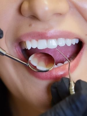 Dentista vigo. imagen de una cara con la boca abierta en dentista